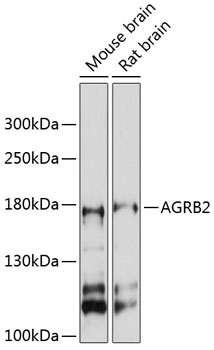 AGRB2 Rabbit Polyclonal Antibody