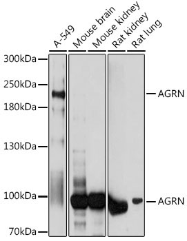 AGRN Rabbit Polyclonal Antibody