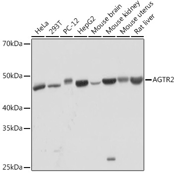 AGTR2 Rabbit Monoclonal Antibody