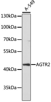 AGTR2 Rabbit Polyclonal Antibody