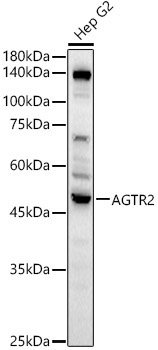 AGTR2 Rabbit Polyclonal Antibody