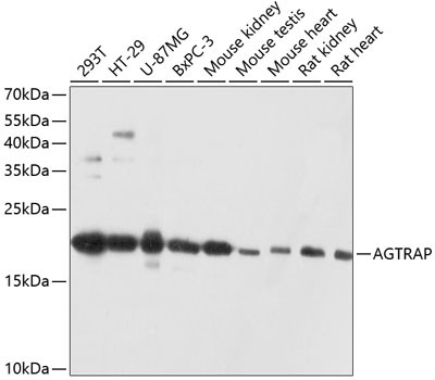 AGTRAP Rabbit Polyclonal Antibody