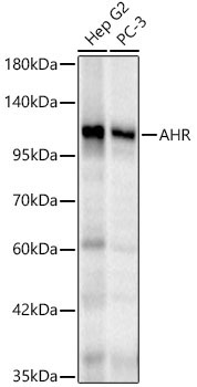 AHR Rabbit Polyclonal Antibody