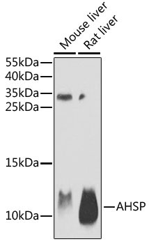 AHSP Rabbit Polyclonal Antibody