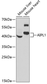AIPL1 Rabbit Polyclonal Antibody