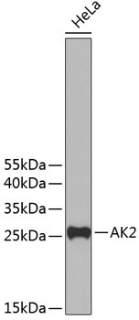 AK2 Rabbit Polyclonal Antibody