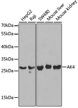 AK4 Rabbit Polyclonal Antibody