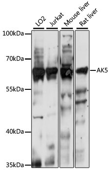 AK5 Rabbit Polyclonal Antibody