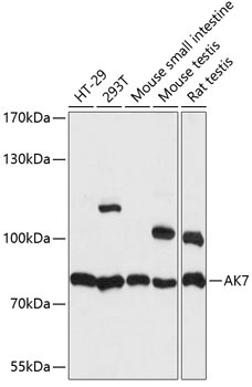AK7 Rabbit Polyclonal Antibody