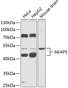 AKAP5 Rabbit Polyclonal Antibody