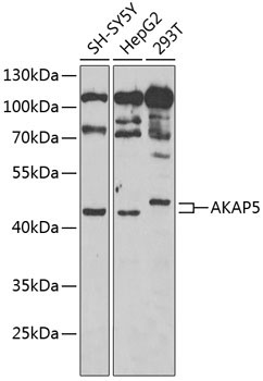 AKAP5 Rabbit Polyclonal Antibody