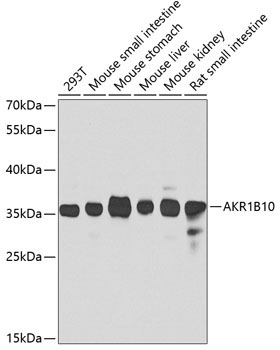 AKR1B10 Rabbit Polyclonal Antibody