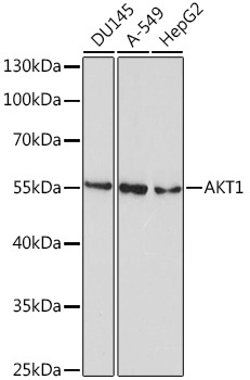 AKT1 Mouse Monoclonal Antibody