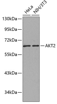 AKT2 Rabbit Polyclonal Antibody