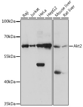 Akt2 Rabbit Polyclonal Antibody