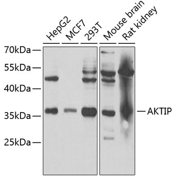 AKTIP Rabbit Polyclonal Antibody