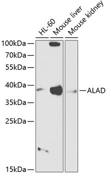 ALAD Rabbit Polyclonal Antibody