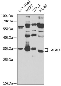 ALAD Rabbit Polyclonal Antibody