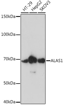 ALAS1 Rabbit Monoclonal Antibody