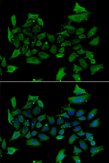 ALAS1 Rabbit Polyclonal Antibody
