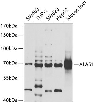 ALAS1 Rabbit Polyclonal Antibody