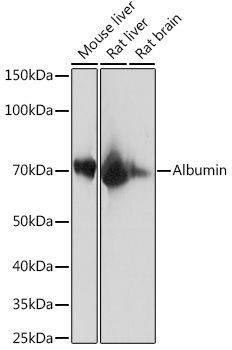 Albumin Rabbit Monoclonal Antibody
