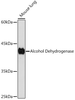 Alcohol Dehydrogenase Rabbit Monoclonal Antibody