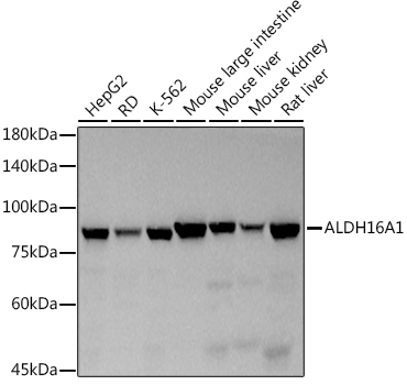 ALDH16A1 Rabbit Monoclonal Antibody