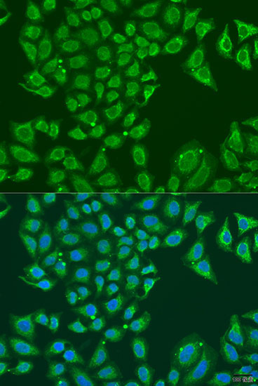 ALDH1B1 Rabbit Polyclonal Antibody