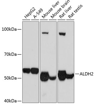 ALDH2 Rabbit Monoclonal Antibody