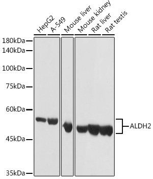 ALDH2 Rabbit Polyclonal Antibody