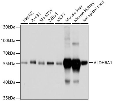 ALDH6A1 Rabbit Polyclonal Antibody
