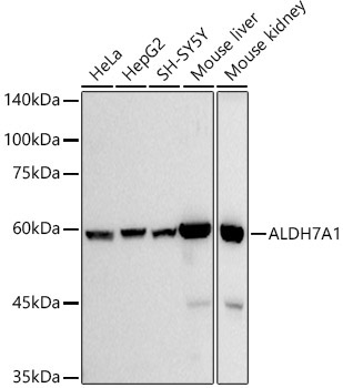 ALDH7A1 Rabbit Monoclonal Antibody