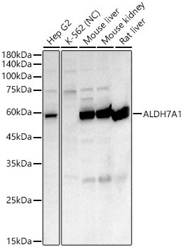 ALDH7A1 Rabbit Polyclonal Antibody