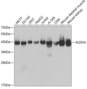 ALDOA Rabbit Polyclonal Antibody
