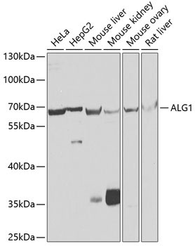ALG1 Rabbit Polyclonal Antibody