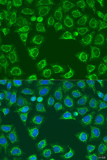 ALG2 Rabbit Polyclonal Antibody