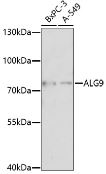 ALG9 Rabbit Polyclonal Antibody