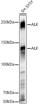ALK Rabbit Polyclonal Antibody