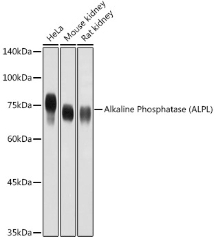 Alkaline Phosphatase (ALPL) Rabbit Polyclonal Antibody