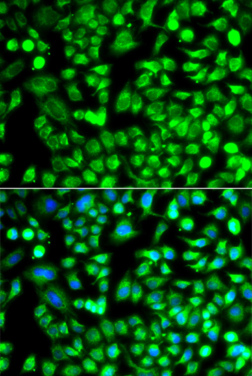 ALKBH4 Rabbit Polyclonal Antibody
