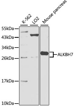 ALKBH7 Rabbit Polyclonal Antibody