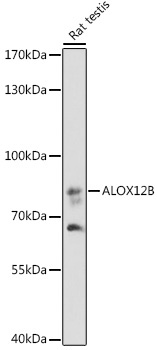 ALOX12B Rabbit Polyclonal Antibody