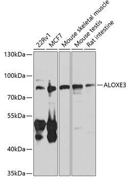 ALOXE3 Rabbit Polyclonal Antibody