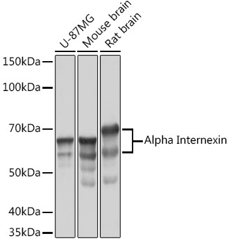 Alpha Internexin Rabbit Monoclonal Antibody