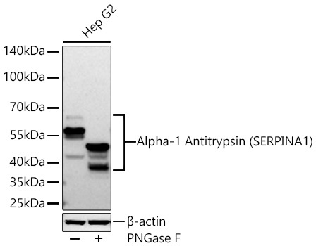 Alpha-1 Antitrypsin (SERPINA1) Rabbit Monoclonal Antibody