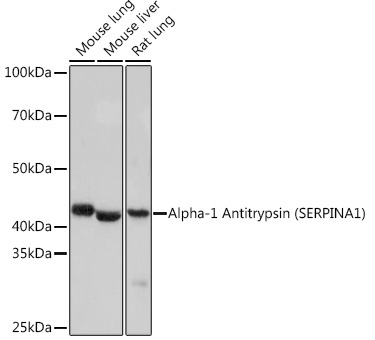 Alpha-1 Antitrypsin (SERPINA1) Rabbit Monoclonal Antibody