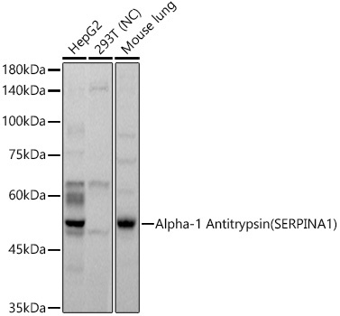 Alpha-1 Antitrypsin (SERPINA1) Rabbit Polyclonal Antibody