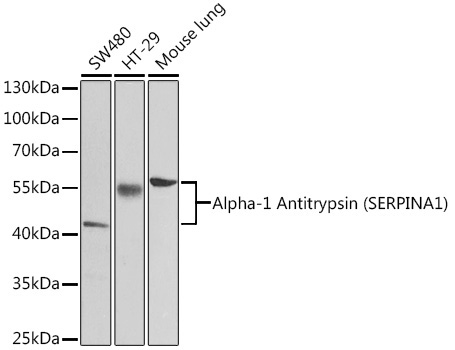 Alpha-1 Antitrypsin (SERPINA1) Rabbit Polyclonal Antibody