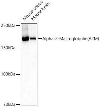 Alpha-2-Macroglobulin (A2M) Rabbit Polyclonal Antibody